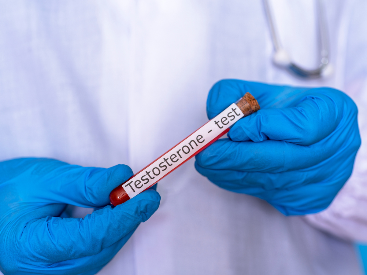Signs-Your-Testosterone-Levels-Are-Improving-During-Therapy