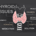 Thyroid Levels