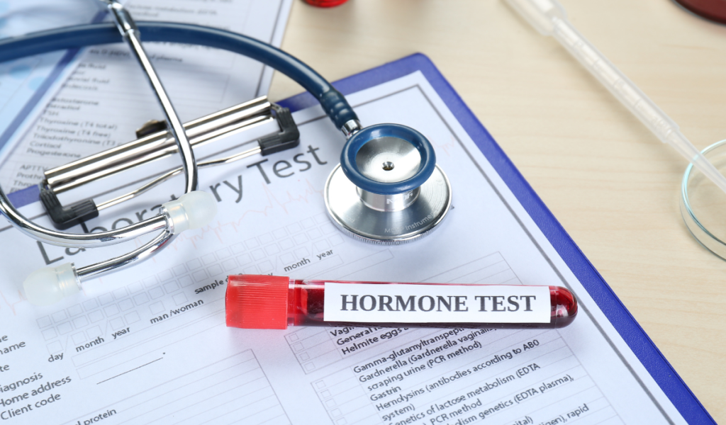 Lab Tests Do You Need Before Starting Hormone Therapy 2