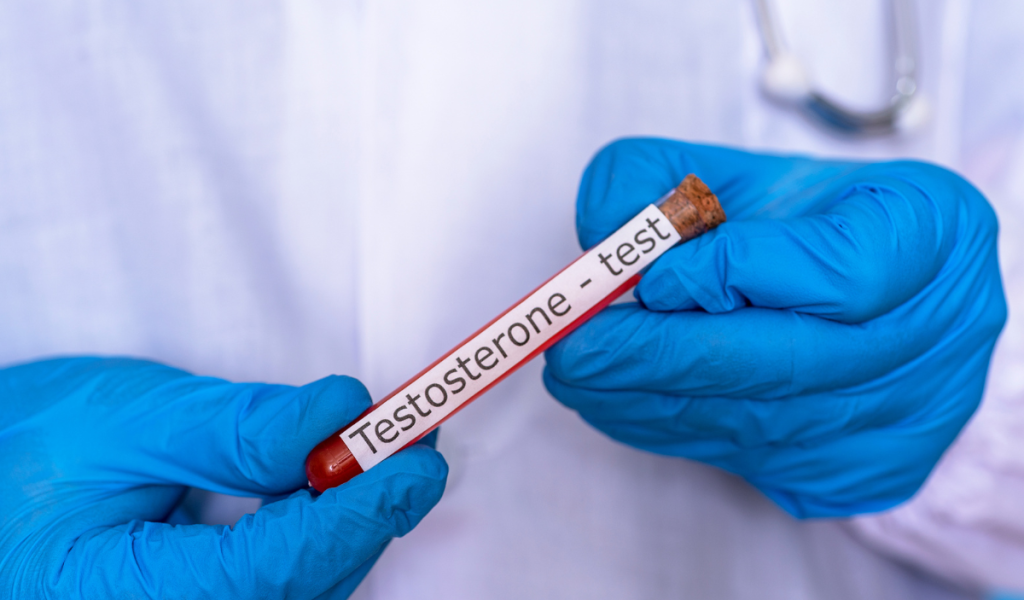 Signs-Your-Testosterone-Levels-Are-Improving-During-Therapy