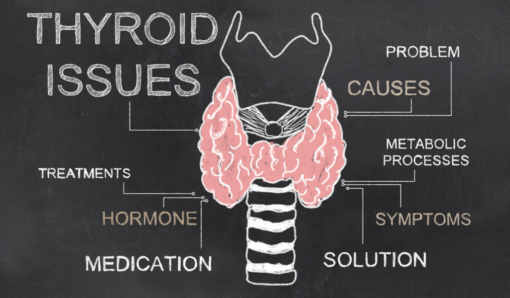 Thyroid Levels